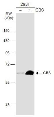 Western Blot: CBS Antibody (519) [NBP2-43604]