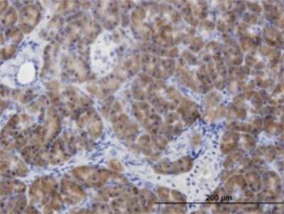 Immunohistochemistry-Paraffin: CBS Antibody (5F7) [H00000875-M07]