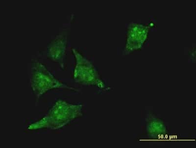 Immunocytochemistry/ Immunofluorescence: CBS Antibody (6A9) [H00000875-M06]