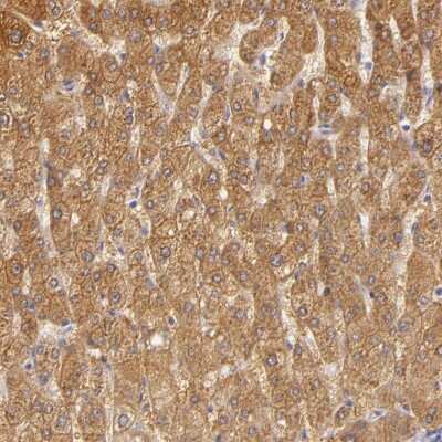 Immunohistochemistry-Paraffin: CBS Antibody [NBP1-83255]
