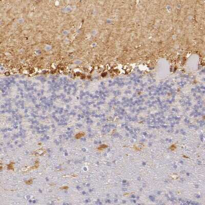 Immunohistochemistry-Paraffin: CBS Antibody [NBP1-83255]