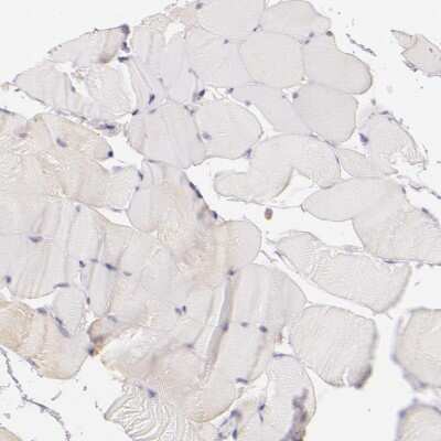 Immunohistochemistry-Paraffin: CBS Antibody [NBP1-83255]