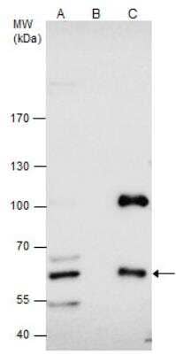 Immunoprecipitation: CBS Antibody [NBP1-33518]