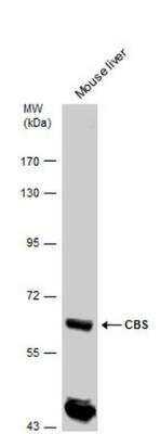 Western Blot: CBS Antibody [NBP1-33518]