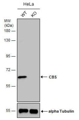 Knockout Validated: CBS Antibody [NBP1-33518]