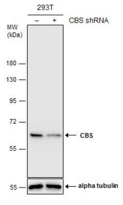 Knockdown Validated: CBS Antibody [NBP1-33518]