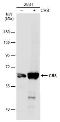 Western Blot: CBS Antibody [NBP1-33518]