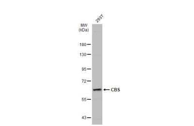 Western Blot: CBS Antibody [NBP1-33518]