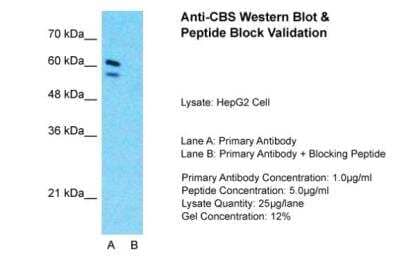 Western Blot: CBS Antibody [NBP1-52850]