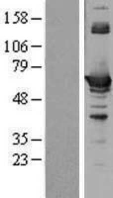 Western Blot: CBS Overexpression Lysate [NBL1-08744]