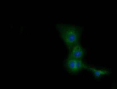 Immunocytochemistry/ Immunofluorescence: CBWD1 Antibody (OTI4D4) [NBP2-02931]