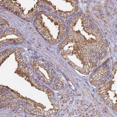 Immunohistochemistry: CBWD1 Antibody [NBP2-46683]
