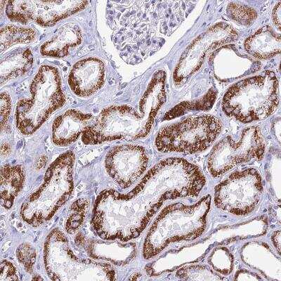 Immunohistochemistry: CBWD1 Antibody [NBP2-46685]