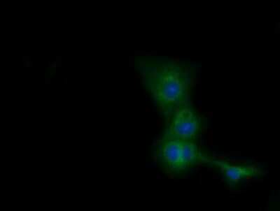 Immunocytochemistry/ Immunofluorescence: CBWD1 Antibody (OTI4D4) - Azide and BSA Free [NBP2-72027]