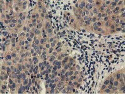 Immunohistochemistry: CBWD1 Antibody (OTI4D4) - Azide and BSA Free [NBP2-72027]