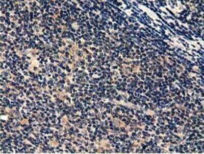 Immunohistochemistry: CBWD1 Antibody (OTI4D4) - Azide and BSA Free [NBP2-72027]
