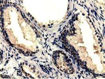 Immunohistochemistry: CBWD1 Antibody (OTI4D4) - Azide and BSA Free [NBP2-72027]