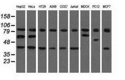 Western Blot: CBWD1 Antibody (OTI4D4)Azide and BSA Free [NBP2-72027]