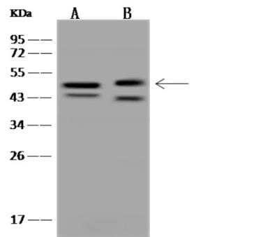 Western Blot: CBWD1 Antibody [NBP3-05877]