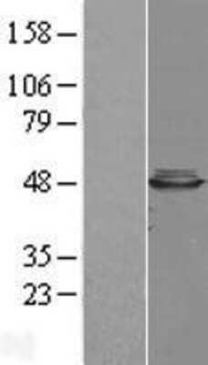 Western Blot: CBWD1 Overexpression Lysate [NBL1-08745]