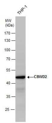 Western Blot: CBWD2 Antibody [NBP2-43605]