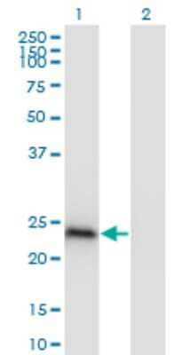 Western Blot: CBX1 Antibody (4E12) [H00010951-M01]