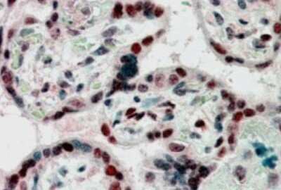 Immunohistochemistry-Paraffin: CBX1 Antibody [NB100-2423]