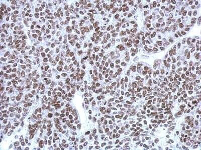 Immunohistochemistry-Paraffin: CBX1 Antibody [NBP2-14899]