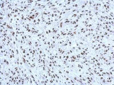 Immunohistochemistry-Paraffin: CBX1 Antibody [NBP2-14899]