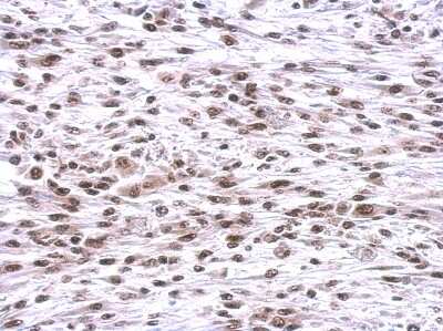 Immunohistochemistry-Paraffin: CBX1 Antibody [NBP2-14900]