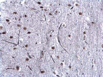 Immunohistochemistry-Paraffin: CBX1 Antibody [NBP2-14900]