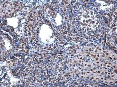 Immunohistochemistry-Paraffin: CBX1 Antibody [NBP2-14900]