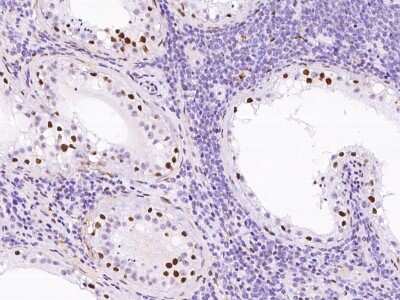 Immunohistochemistry-Paraffin: CBX1 Antibody [NBP2-98756]