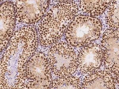 Immunohistochemistry-Paraffin: CBX1 Antibody [NBP2-98756]