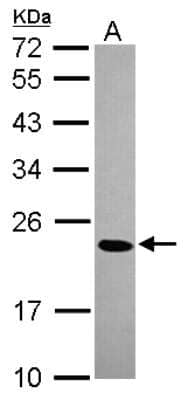 Western Blot: CBX1 Antibody [NBP2-14899]