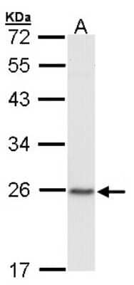 Western Blot: CBX1 Antibody [NBP2-14900]