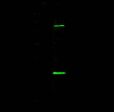 Western Blot: CBX1 Antibody [NBP2-98755]