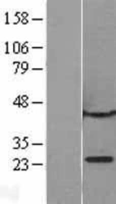 Western Blot: CBX1 Overexpression Lysate [NBL1-08746]