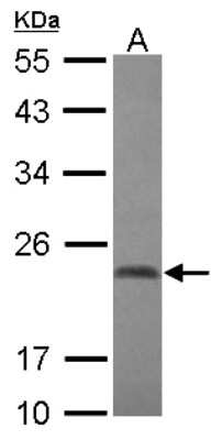 Western Blot: Cbx2 Antibody [NBP2-15735]