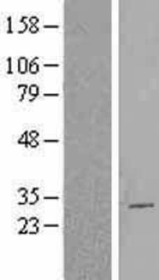 Western Blot: Cbx2 Overexpression Lysate [NBL1-08747]