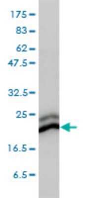 Western Blot: CBX3 Antibody (1G12-1D9) [H00011335-M01]