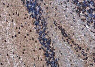 Immunohistochemistry-Paraffin: CBX3 Antibody [NBP2-15736]