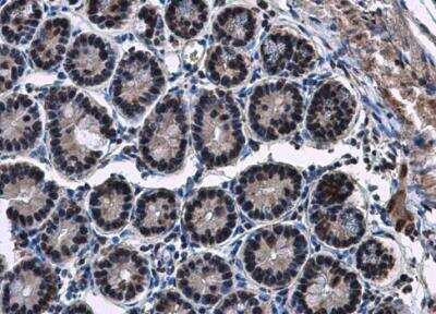 Immunohistochemistry-Paraffin: CBX3 Antibody [NBP2-15736]