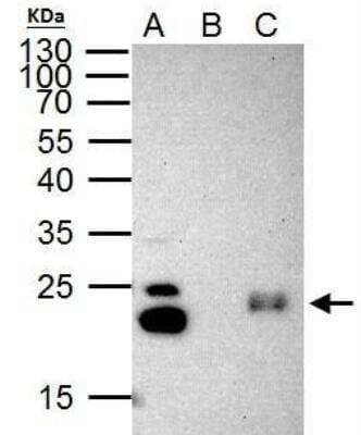 Immunoprecipitation: CBX3 Antibody [NBP2-15736]