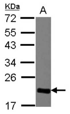 Western Blot: CBX3 Antibody [NBP2-15736]