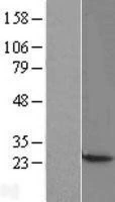 Western Blot: CBX3 Overexpression Lysate [NBL1-08748]