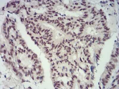 Immunohistochemistry-Paraffin: CBX4 Antibody (6C5G3) - BSA Free [NBP2-52432]