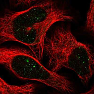 Immunocytochemistry/ Immunofluorescence: CBX4 Antibody [NBP2-55246]