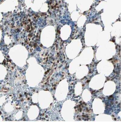 Immunohistochemistry-Paraffin: CBX4 Antibody [NBP1-83225]