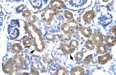 Immunohistochemistry-Paraffin: CBX4 Antibody [NBP3-10881]